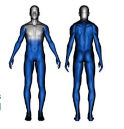 TASER Preferred Target Areas Shown In Blue (Source: TASER International Training Bulletin 15) 